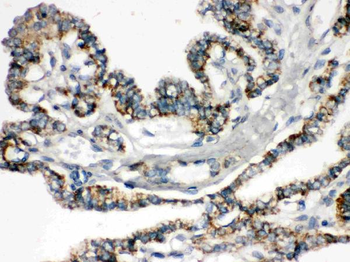 Anti-Bik Antibody