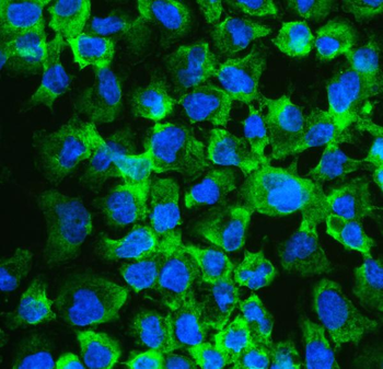 Anti-eIF4A2 Antibody