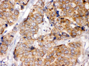 Anti-eIF4A2 Antibody