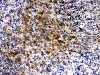 Anti-eIF4A2 Antibody