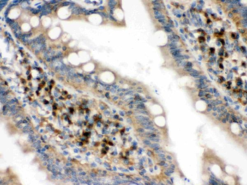 Anti-eIF4A2 Antibody