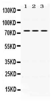 IL2 Receptor beta/IL2RB Antibody