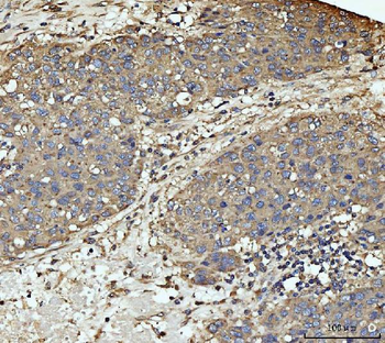 Anti-MEK3/MAP2K3 Antibody