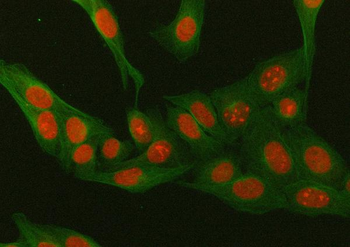 Mineralocorticoid Receptor/NR3C2 Rabbit Polyclonal Antibody
