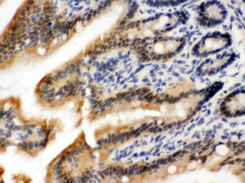Anti-OGT/O-Linked N-Acetylglucosamine Transferase Antibody