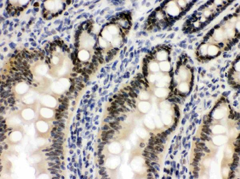 Anti-OGT/O-Linked N-Acetylglucosamine Transferase Antibody