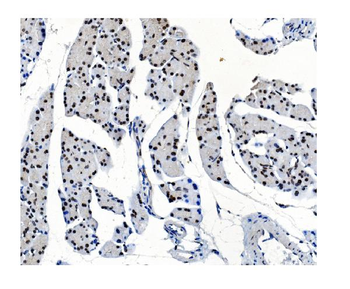 Anti-OGT/O-Linked N-Acetylglucosamine Transferase Antibody