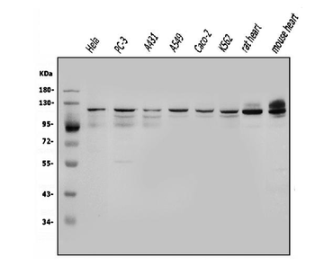 Anti-OGT/O-Linked N-Acetylglucosamine Transferase Antibody