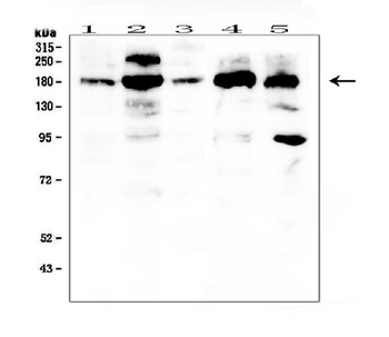 Anti-PDGF Receptor alpha/PDGFRA Antibody