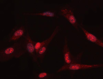 Anti-PGK1 Antibody
