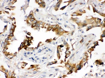 PGRMC1 Antibody