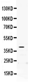 PON2 Rabbit Polyclonal Antibody