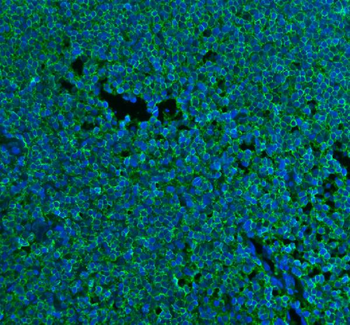 Anti-CD45/PTPRC Antibody