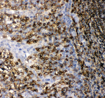 Anti-CD45/PTPRC Antibody