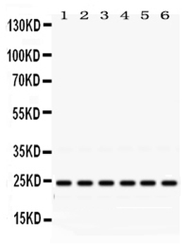 Anti-Rab5/RAB5A Antibody