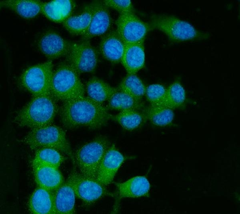 Anti-RAB13 Antibody