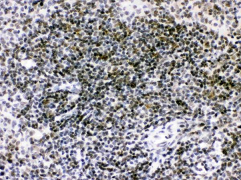 Anti-RAG2 Antibody