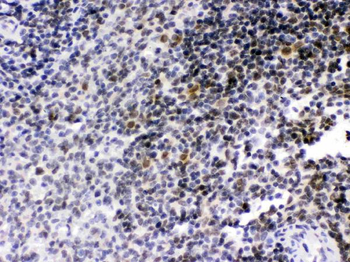 Anti-RAG2 Antibody