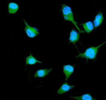 Anti-RALB Antibody