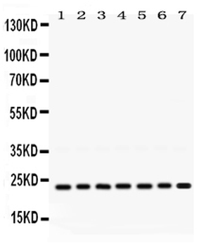 Anti-RALB Antibody