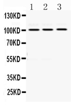 Anti-RASA1 Antibody