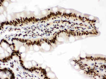 Anti-RbAp48/RBBP4 Antibody