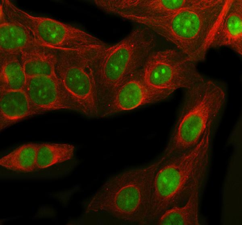 Anti-RbAp48/RBBP4 Antibody