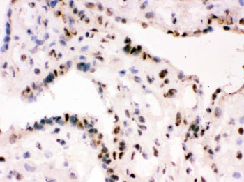 Anti-RbAp48/RBBP4 Antibody