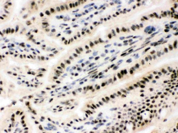 Anti-RbAp48/RBBP4 Antibody