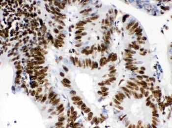 Anti-RbAp48/RBBP4 Antibody