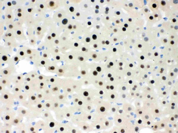 Anti-RbAp48/RBBP4 Antibody