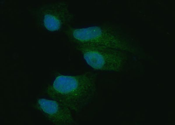 Anti-PKR/EIF2AK2 Antibody