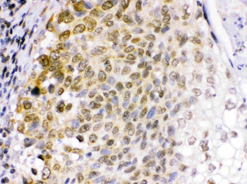 Anti-EME1 Antibody