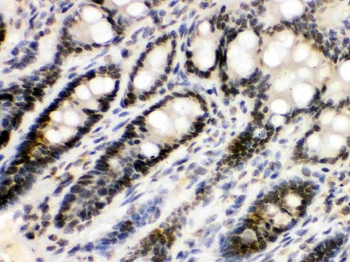 Anti-EME1 Antibody