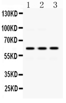 Anti-EME1 Antibody