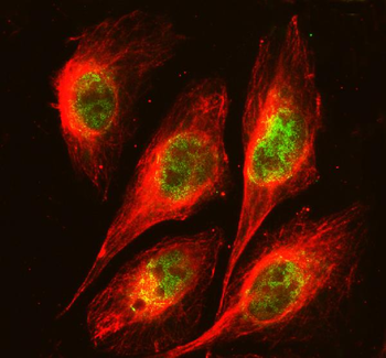 Anti-FOXA3 Antibody
