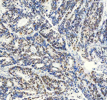 Anti-FOXA3 Antibody