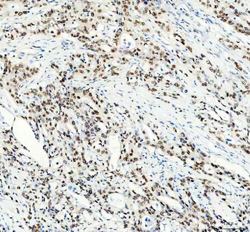 Anti-FOXA3 Antibody