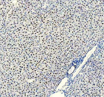 Anti-FOXA3 Antibody