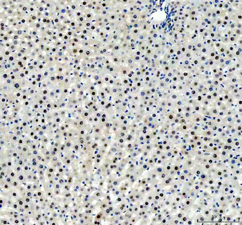 Anti-FOXA3 Antibody