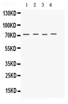 Anti-Kv1.4/KCNA4 Antibody