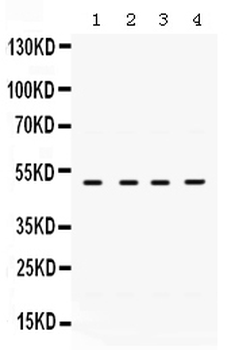 Anti-RRM2 Antibody