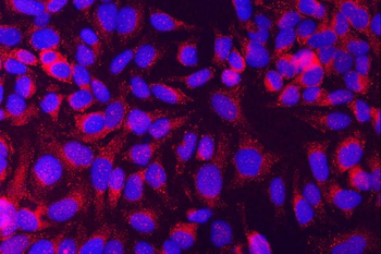 Anti-Munc18-1/STXBP1 Antibody