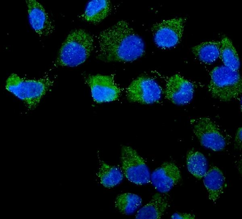 Anti-STXBP2 Antibody