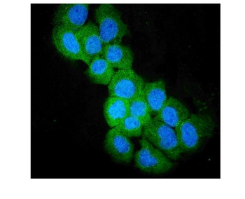 Anti-SULT2B1 Antibody