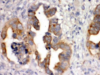 Anti-SULT2B1 Antibody