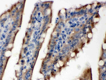 Anti-SULT2B1 Antibody
