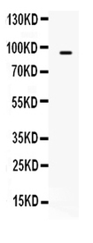 TAP2 Rabbit Polyclonal Antibody