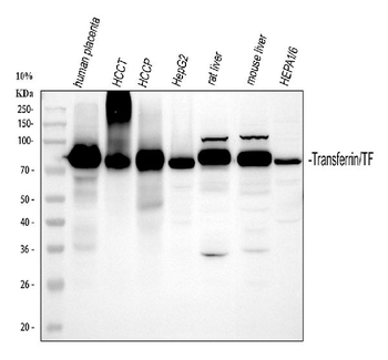 Anti-Transferrin/TF Antibody
