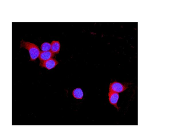 Anti-TNXB Antibody